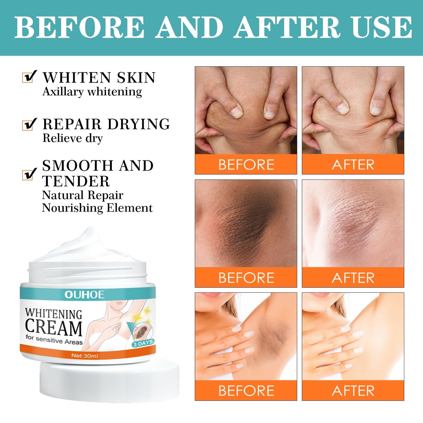 OUHOE Whitening Cream for Sensitive Areas