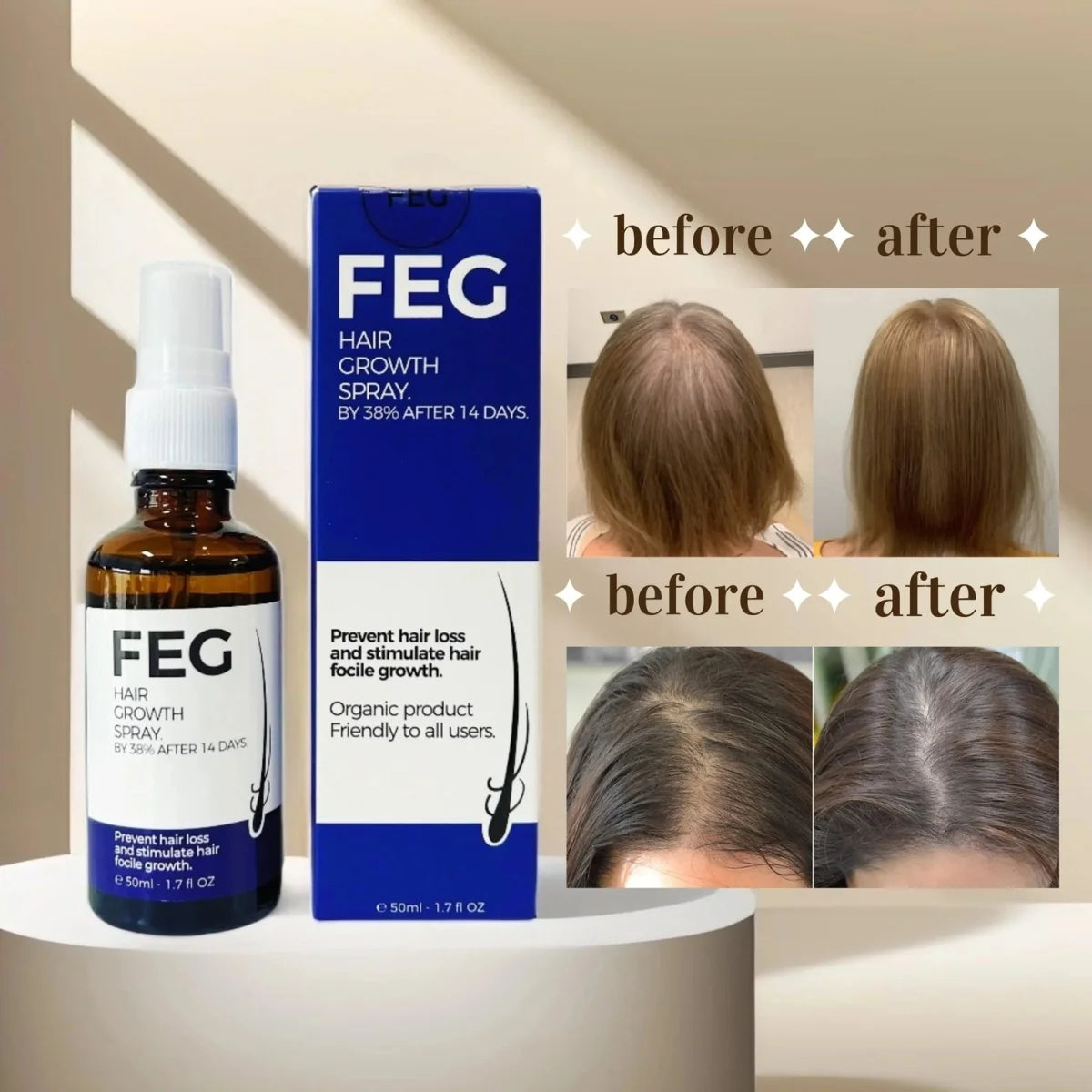 FEG Hair Growth & Anti-Hair Loss Serum / Spray - 50 ml | Fast Regrowth & Anti-Hair Fall Solution